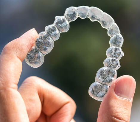 Clear Aligners in Lynnwood