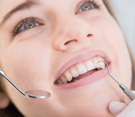 Dental Crowns in Lynnwood