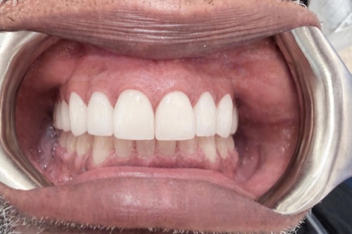 After — Recent Case