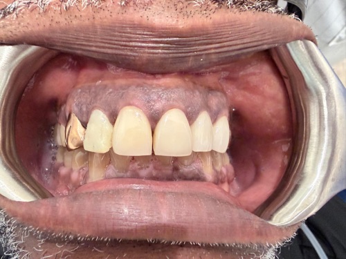 Before — Recent Case